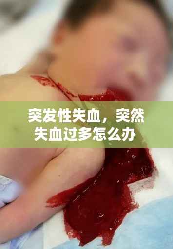 突发性失血，突然失血过多怎么办 